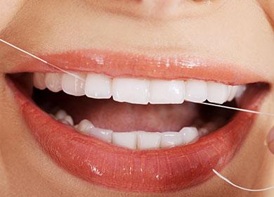 Soie dentaire