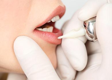 Tatouage de la lèvre