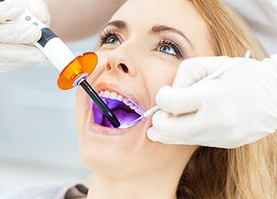 Professionel tandblegning