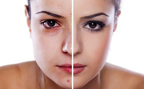 Ang batang babae na may mahinang balat ay nagapi ang balakid na ito.