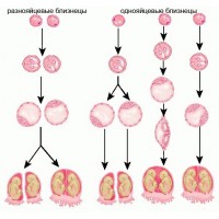 Ipinapakita ng figure kung paano ito o na kambal
