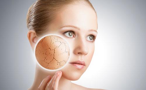 Peau sèche