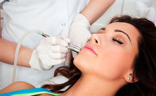 Chemický peeling obličeje