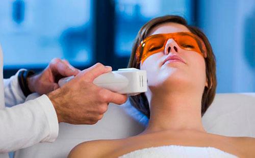 Ang pagtanggal ng buhok ng laser