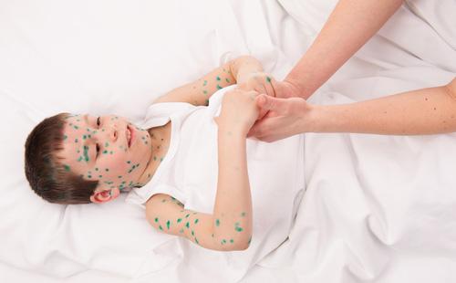 El niño manchado de verde