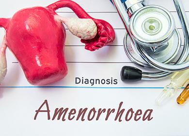 Modelo médico de órganos internos femeninos.