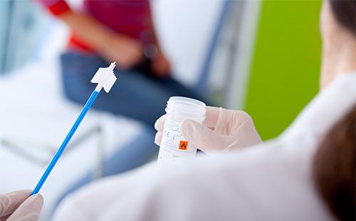 Frotis ginecológico