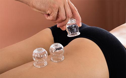 Bocaux pour massage anti-cellulite