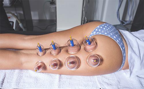 Des canettes sur le pied