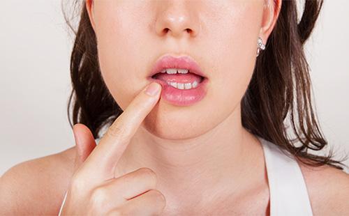 Herpes en los labios