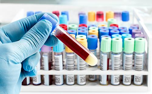 Sang de tube à essai