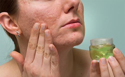 Les femmes frottent la peau avec une lotion