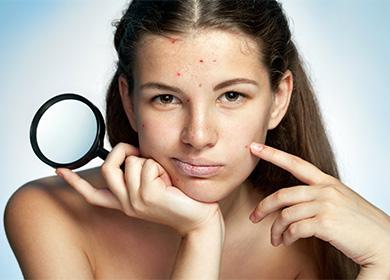 Femme avec peau à problèmes