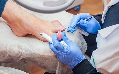 El doctor trata los dedos de los pies