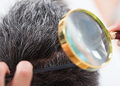 Le médecin examine les cheveux du patient