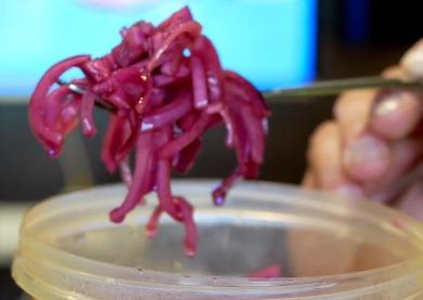 Köstliche eingelegte rote  Zwiebel